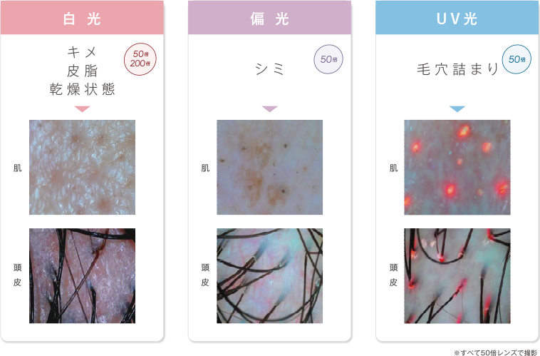 ３つの光で分かる肌状態